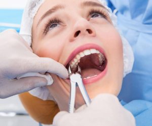 Young woman having tooth removed. Close up picture of a woman mouth with a dentist hand holding extraction forceps